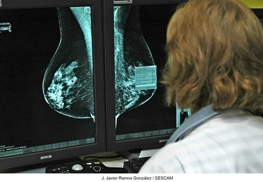 Cáncer de mama Mamografía médicos. Foto J Javier Ramos Junta CLM