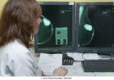 20170109 Mamografo 6