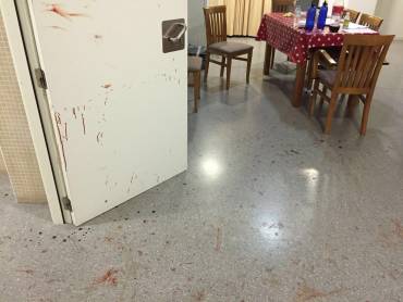 Agresion EAP El Casar. 2