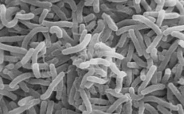 Vibrio cholerae la bacteria que causa el cólera Wikipedia